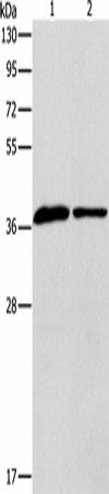 Western blot analysis of Human fetal liver tissue huvec cells using APOL2 Polyclonal Antibody at dilution of 1:725