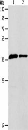 Western blot analysis of Human fetal liver tissue huvec cells using APOL2 Polyclonal Antibody at dilution of 1:725