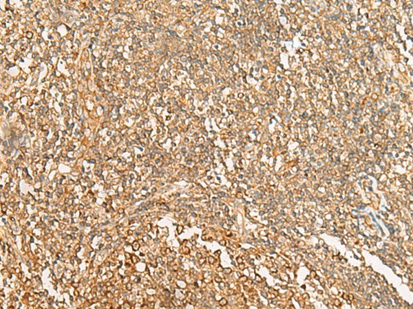 Immunohistochemistry of paraffin-embedded Human tonsil tissue using NARS Polyclonal Antibody at dilution of 1:30(×200)