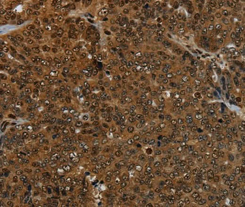 Anti-Human KDM4B Antibody - ABMIUM