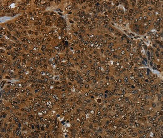 Anti-Human KDM4B Antibody - ABMIUM