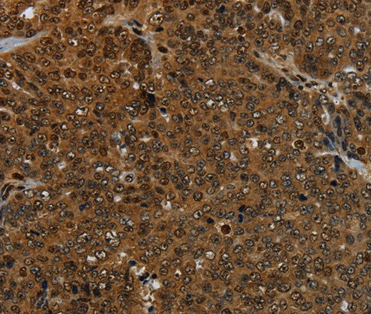 Anti-Human KDM4B Antibody - ABMIUM