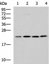 Western blot analysis of K562 A172 Jurkat LOVO cell lysates using MRPL40 Polyclonal Antibody at dilution of 1:1000