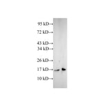 Western Blot analysis of A431 and Jurkat cells using CFL1 Polyclonal Antibody at dilution of 1:600