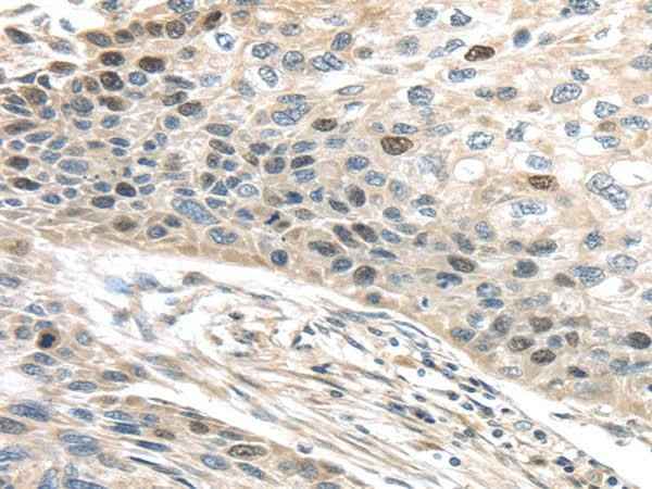 Anti-Human/Mouse TPX2 Antibody