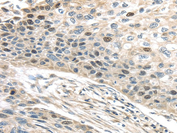 Anti-Human/Mouse TPX2 Antibody - ABMIUM