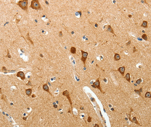 Anti-Human/Mouse BIRC6 Antibody - ABMIUM