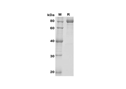 SDS-PAGE analysis of Mouse OPG proteins, 2 μg/lane of Recombinant Mouse OPG TARC proteins was resolved with SDS-PAGE under reducing conditions, showing bands at 80 kDa.