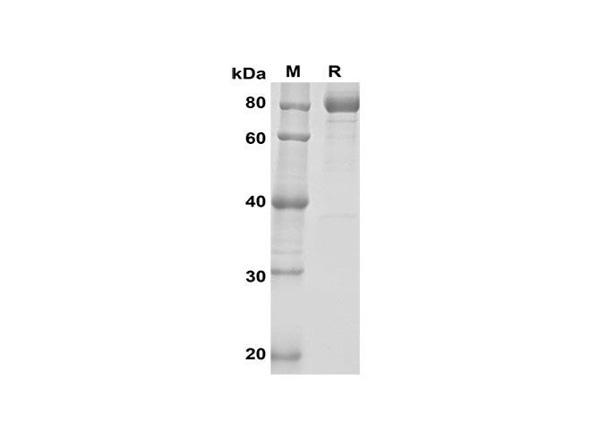 SDS-PAGE analysis of Mouse OPG proteins, 2 μg/lane of Recombinant Mouse OPG TARC proteins was resolved with SDS-PAGE under reducing conditions, showing bands at 80 kDa.