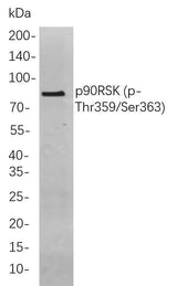 Anti-Human/Mouse/Rat p90RSK（Thr359, Ser363) Antibody [B817]