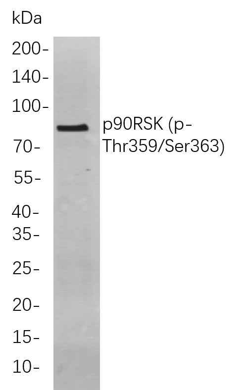 Anti-Human/Mouse/Rat p90RSK（Thr359, Ser363) Antibody [B817] - ABMIUM
