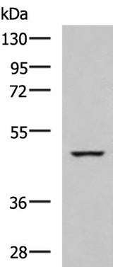 Western blot analysis of K562 cell lysate using IP6K2 Polyclonal Antibody at dilution of 1:650