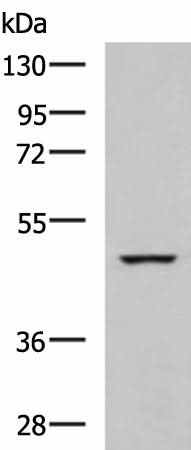 Western blot analysis of K562 cell lysate using IP6K2 Polyclonal Antibody at dilution of 1:650
