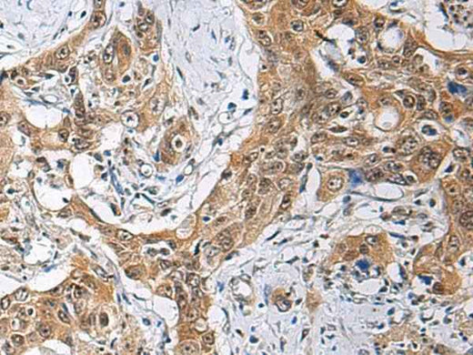 Anti-Human/Mouse THOC3 Antibody