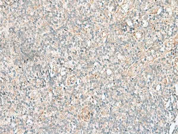 Anti-Human/Mouse/Rat GSKIP Antibody