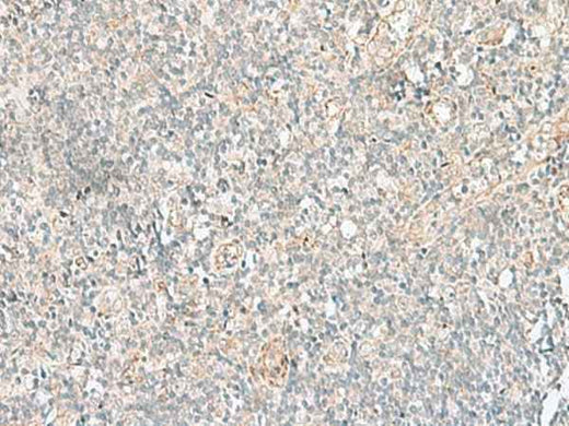 Anti-Human/Mouse/Rat GSKIP Antibody