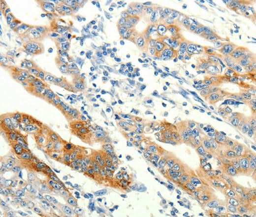 Anti-Human TRPA1 Antibody - ABMIUM