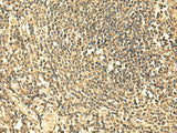 Immunohistochemistry of paraffin-embedded Human tonsil tissue using UNKL Polyclonal Antibody at dilution of 1:50(×200)