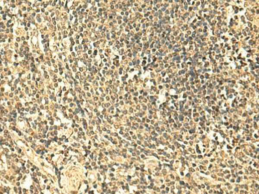 Anti-Human/Mouse UNKL Antibody