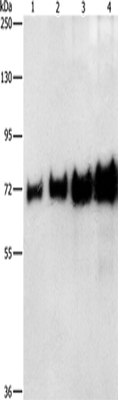 Anti-Bovine serum albumin BSA Antibody - ABMIUM