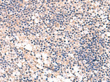 Immunohistochemistry of paraffin-embedded Human tonsil tissue using MKS1 Polyclonal Antibody at dilution of 1:50(×200)