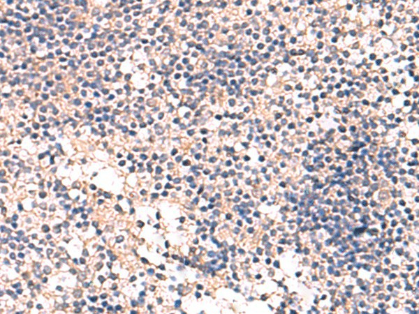Immunohistochemistry of paraffin-embedded Human tonsil tissue using MKS1 Polyclonal Antibody at dilution of 1:50(×200)