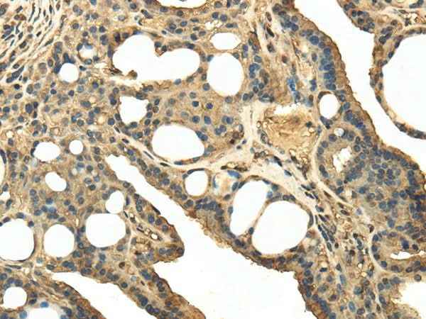 Anti-Human/Mouse TRPC4AP Antibody