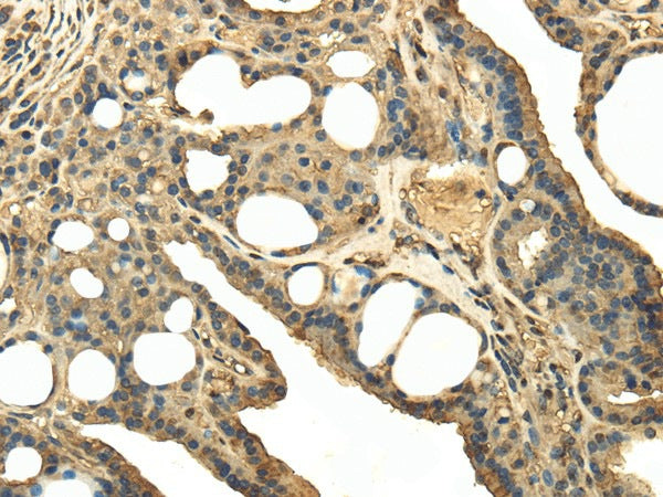 Anti-Human/Mouse TRPC4AP Antibody - ABMIUM