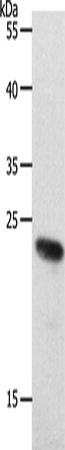Anti-Human RAMP2 Antibody - ABMIUM