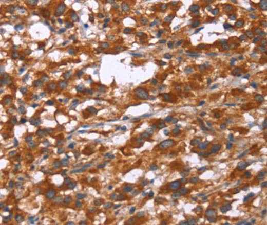 Anti-Human/Mouse/Rat Gphn Antibody