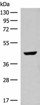 Western blot analysis of Human fetal liver tissue lysate using GNAT1 Polyclonal Antibody at dilution of 1:250