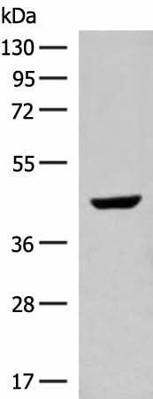 Western blot analysis of Human fetal liver tissue lysate using GNAT1 Polyclonal Antibody at dilution of 1:250