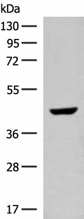 Western blot analysis of Human fetal liver tissue lysate using GNAT1 Polyclonal Antibody at dilution of 1:250