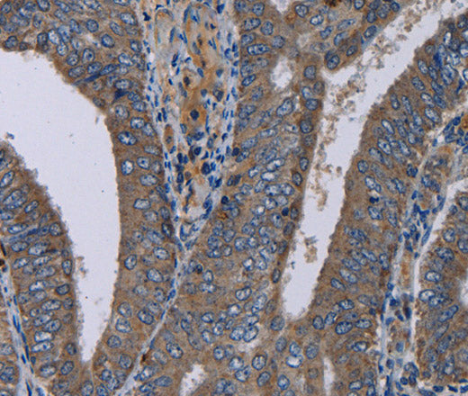 Anti-Human/Mouse NECTIN4 Antibody - ABMIUM