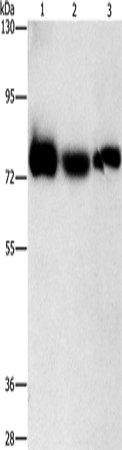 Anti-Human AMPD1 Antibody - ABMIUM