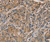 Anti-Human NANOS2 Antibody - ABMIUM