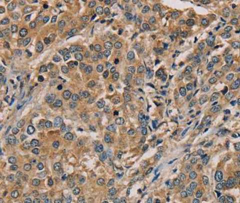 Anti-Human NANOS2 Antibody