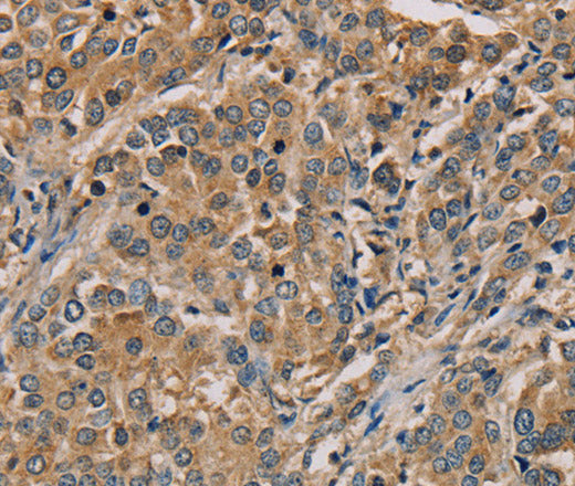 Anti-Human NANOS2 Antibody - ABMIUM