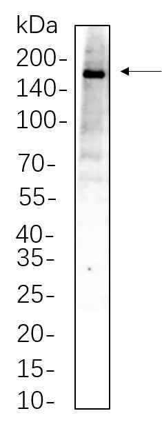 Anti-Human/Mouse TBC1D4 Antibody [B659] - ABMIUM