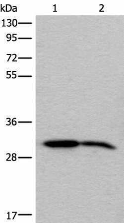 Western blot analysis of Human cerebrum tissue and Mouse brain tissue lysates using IMPA1 Polyclonal Antibody at dilution of 1:300