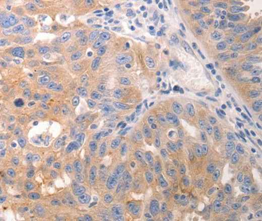 Anti-Human/Mouse KRT6A/KRT6B/KRT6C Antibody