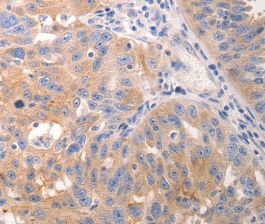 Anti-Human/Mouse KRT6A/KRT6B/KRT6C Antibody - ABMIUM