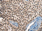 Anti-Human/Mouse CITED2 Antibody - ABMIUM