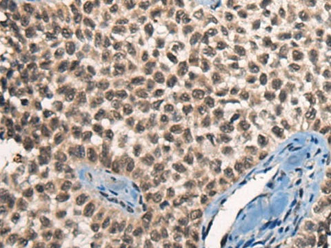 Anti-Human/Mouse CITED2 Antibody - ABMIUM