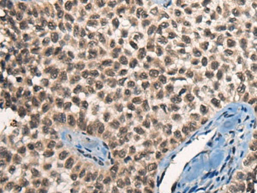 Anti-Human/Mouse CITED2 Antibody - ABMIUM