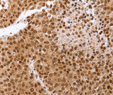 Anti-Human PTTG1 Antibody - ABMIUM