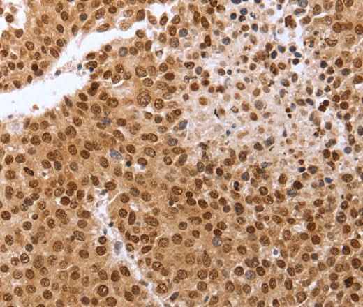 Anti-Human PTTG1 Antibody