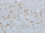 Immunohistochemistry of paraffin-embedded Mouse brain using TIMP4 Polyclonal Antibody at dilution of 1:50