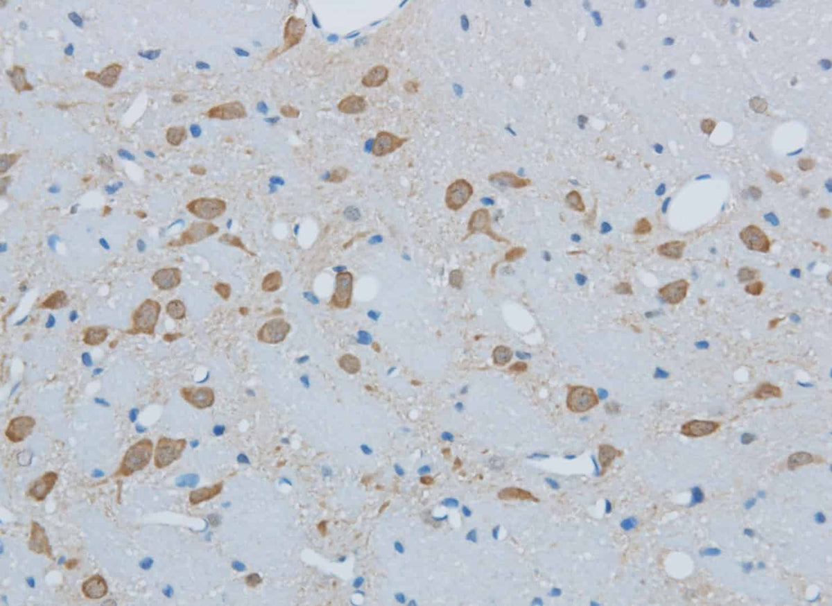 Immunohistochemistry of paraffin-embedded Mouse brain using TIMP4 Polyclonal Antibody at dilution of 1:50