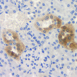 Immunohistochemistry analysis of paraffin-embedded mouse kidney using ROCK1 Polyclonal Antibody at dilution of 1:300.